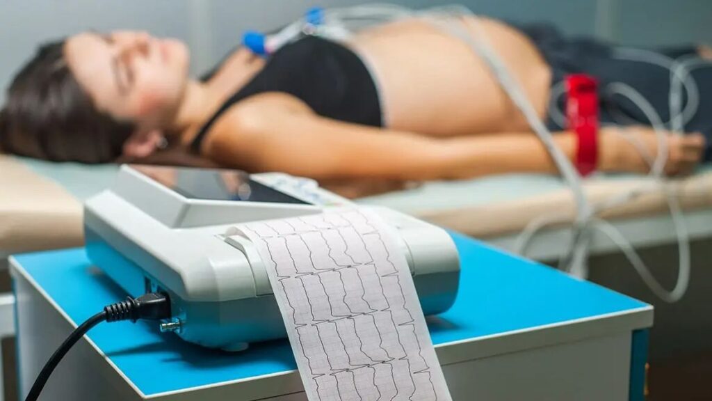 Elettrocardiogramma a riposo